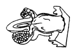 Vermiform