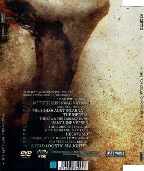 DVD Aborted: The Auricular Chronicles