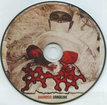 CD Amoclen: Diagnosis: Grindcore