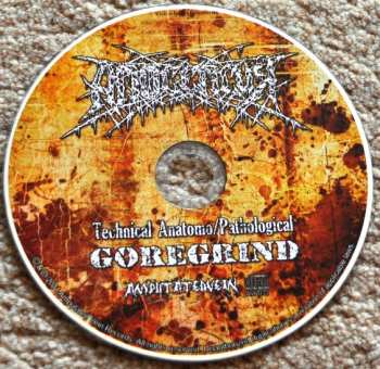 CD Aposepsy: Aposepsy