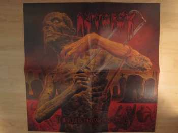 LP Autopsy: Tourniquets, Hacksaws And Graves