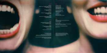 2LP Bebawinigi: Stupor