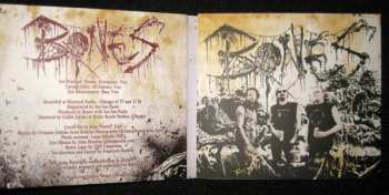 CD Bones: Diseased