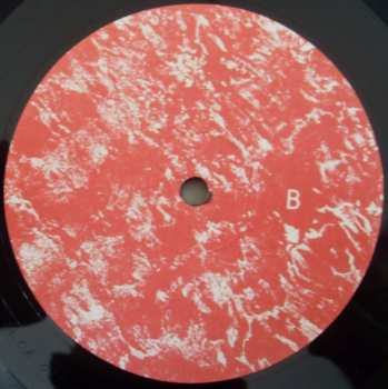 LP Braids: Deep In The Iris