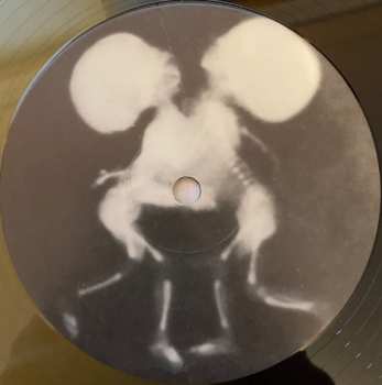 LP Brainoil: Brainoil