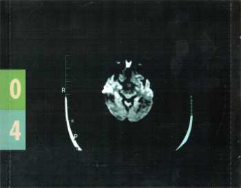 CD Breaking Benjamin: Dear Agony