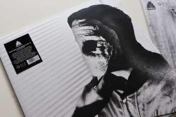 LP Dame Area: La Soluzione É Una