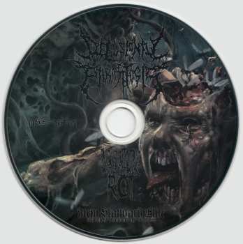 CD Delusional Parasitosis: Ingurgitating Intestinal Rot