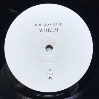 LP Douglas Dare: Whelm LTD