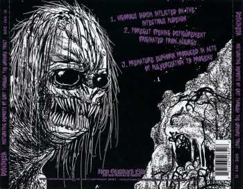 CD Dyskinesia: Micturating Deposits Of Grit Through The Urinary Tract