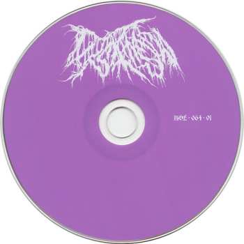 CD Dyskinesia: Micturating Deposits Of Grit Through The Urinary Tract