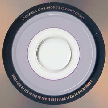 CD Dyskinesia: Micturating Deposits Of Grit Through The Urinary Tract