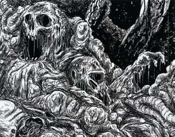 CD Dyskinesia: Micturating Deposits Of Grit Through The Urinary Tract