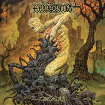 CD Hyperdontia: Hideous Entity