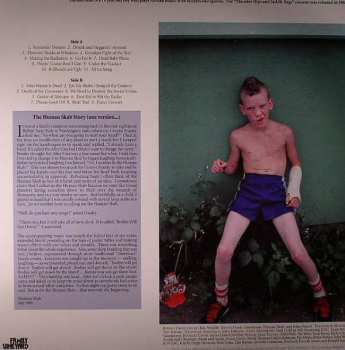 LP Human Skab: Thunder Hips And Saddle Bags