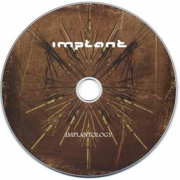 CD Implant: Implantology