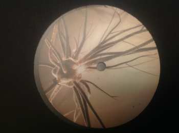 2LP J.G. Thirlwell: Oscillospira