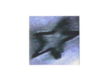 LP La Plata: Sueños