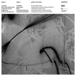 Album Neumatic Parlo: Play It As It Lays