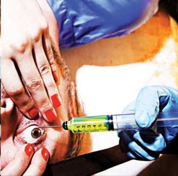 CD Racebannon: IV: Acid Or Blood