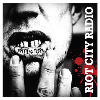 LP Riot City Radio: Spitting Teeth