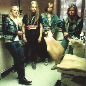 CD Stone: No Anaesthesia!