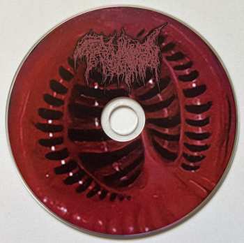 CD Trichomoniasis: Makeshift Crematoria